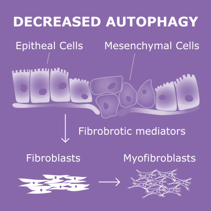 news-autophagy-emt.png