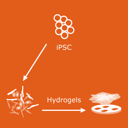 news-fibrosis-progression-model.png