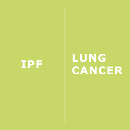 news-ipf-lung-cancer.png